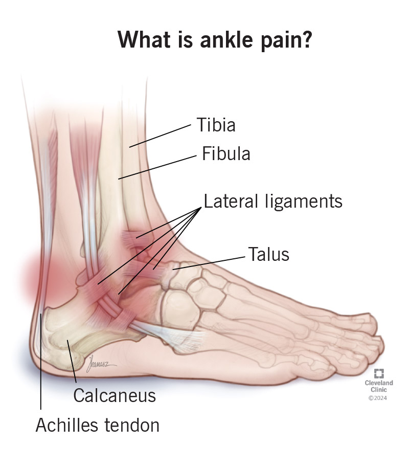relieve-ankle-pain