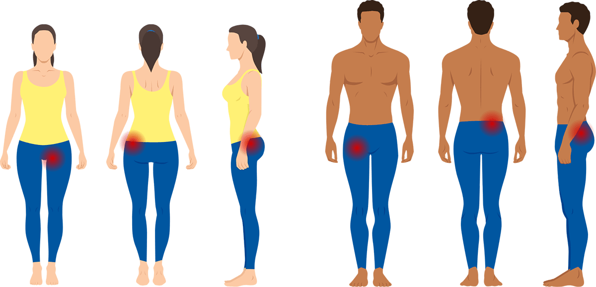 hip-pain