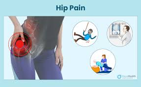 hip-pain