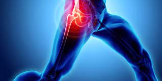 Hip-pain
